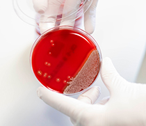 Der Erreger Staphylococcus aureus